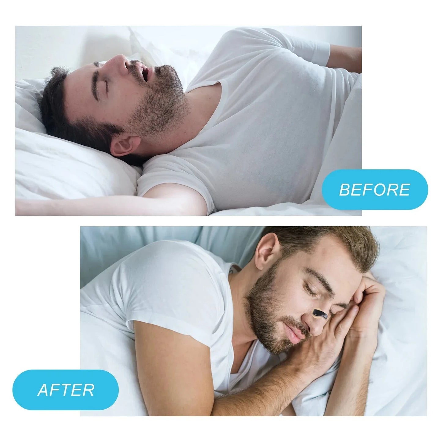 Anti-Snoring Clip