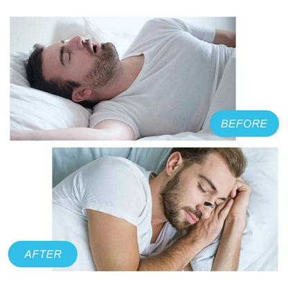 Anti-Snoring Clip